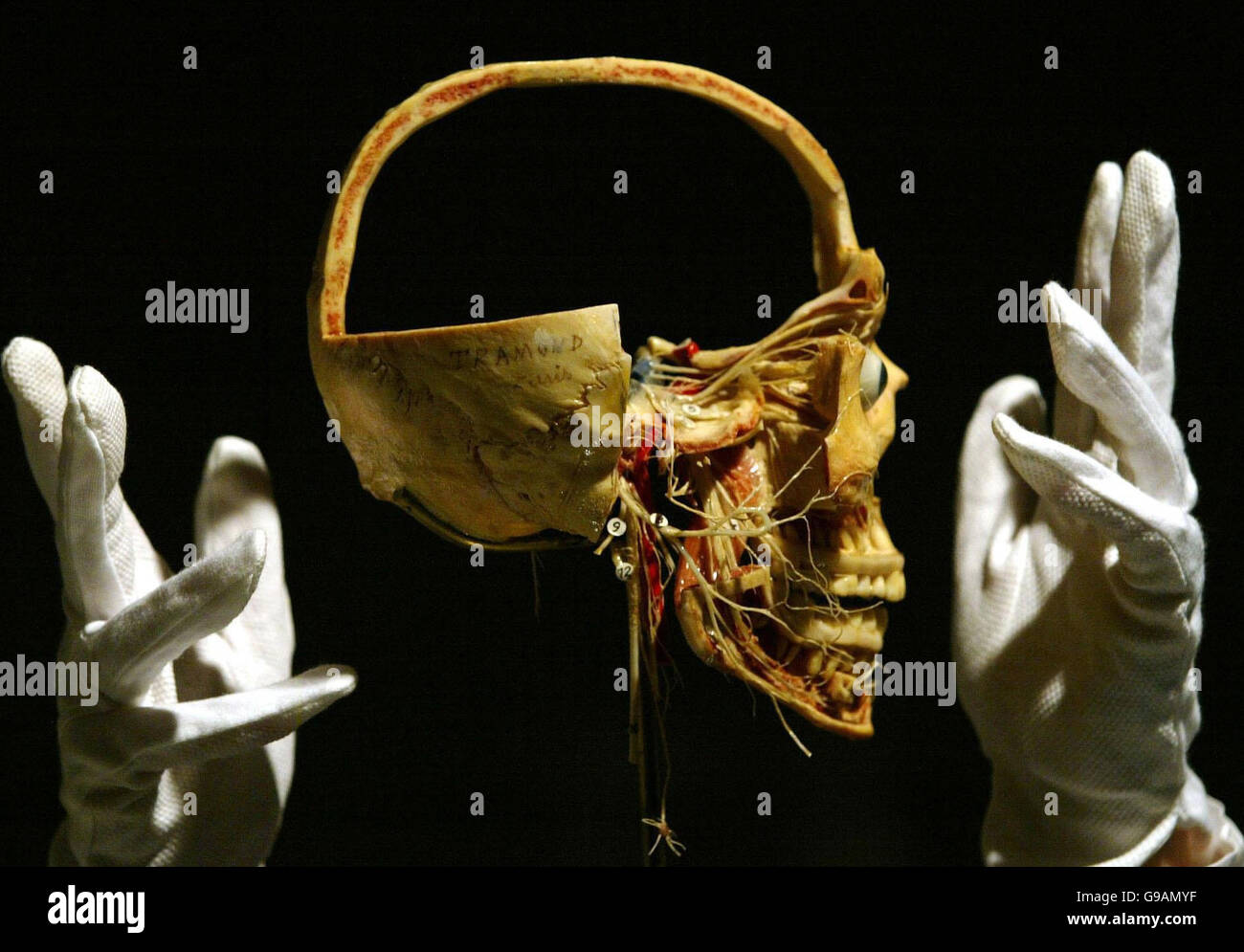 Siobhan McConnachie del Royal Collage of Surgeons guarda un modello di cranio umano disseinato, in mostra come parte degli Anatomy Acts al City Arts Center di Edimburgo, che va dal 13 maggio al 9 luglio. Foto Stock