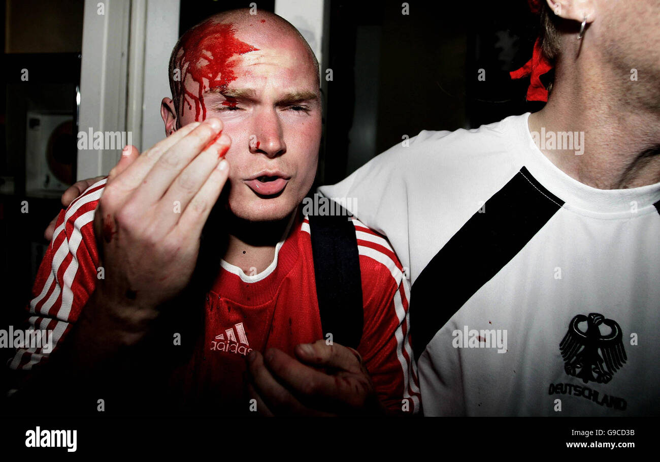 Coppa del mondo 2006 - Clash tifosi tedeschi e polacchi. Un tifoso di calcio polacco con una testa tagliata a Dortmund dopo che la polizia tedesca si scontrò con i tifosi. Foto Stock