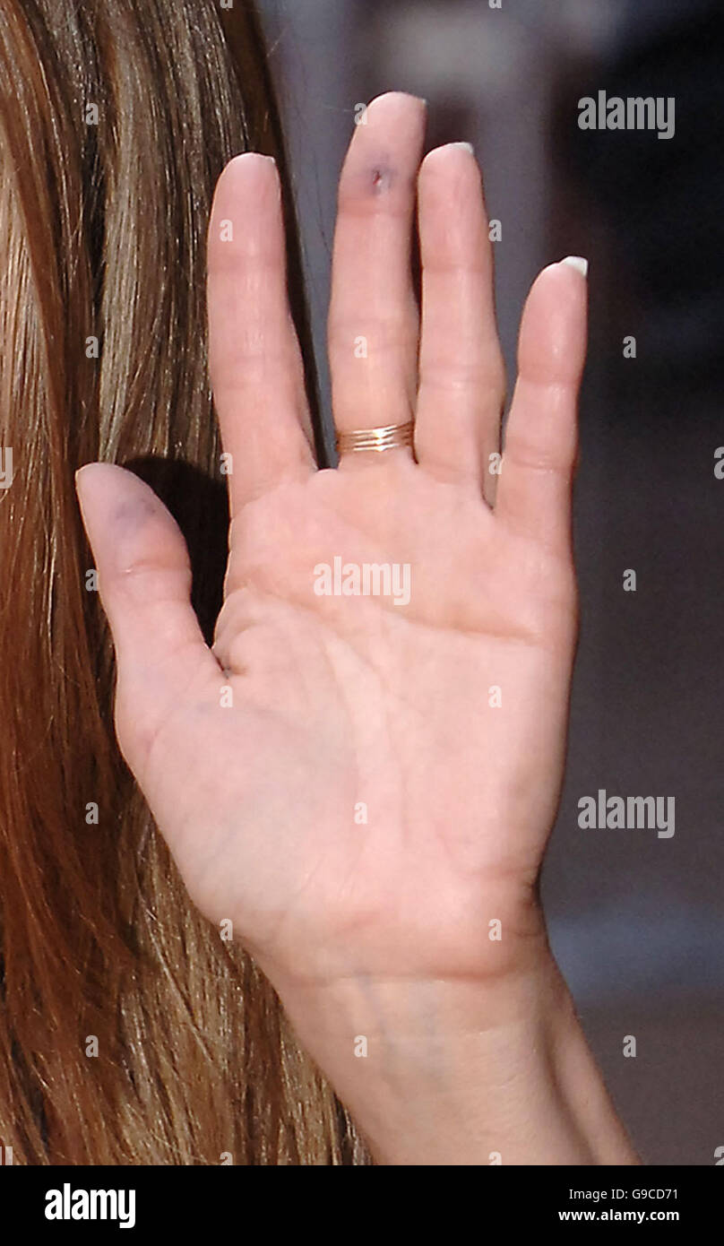 Jennifer Aniston con un taglio/livido sul suo dito, come shearrives presso la UK film premiere di rottura fino al Vue West End cinema, Londra centrale. Foto Stock