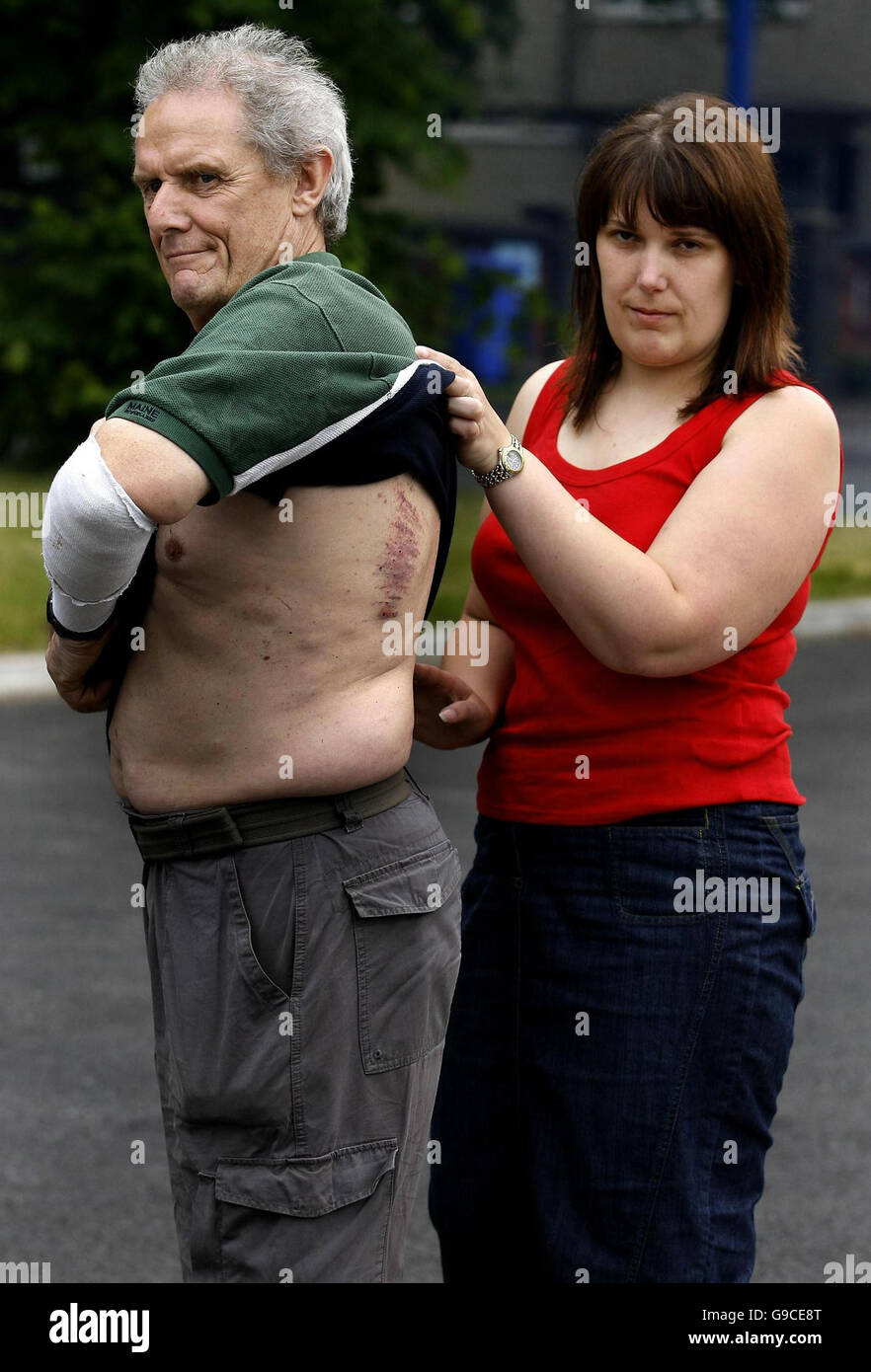 Peter Broadbent è aiutato dalla figlia di Cynthia come egli mostra la sua contusioni al di fuori di Ashton-under-Lyme stazione di polizia in Manchester. Foto Stock