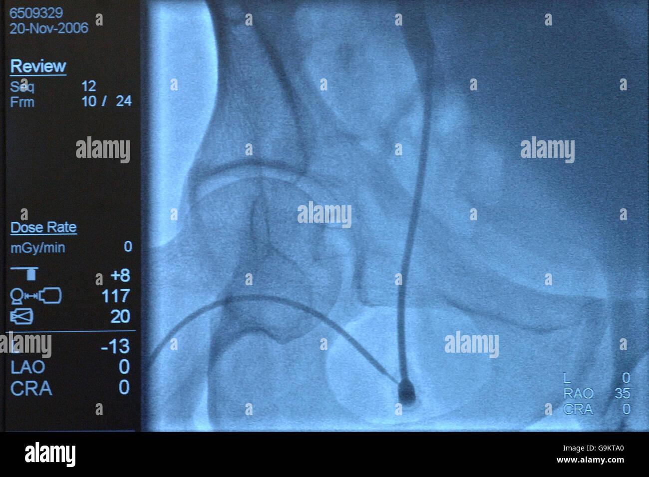 Funzione di salute Foto Stock