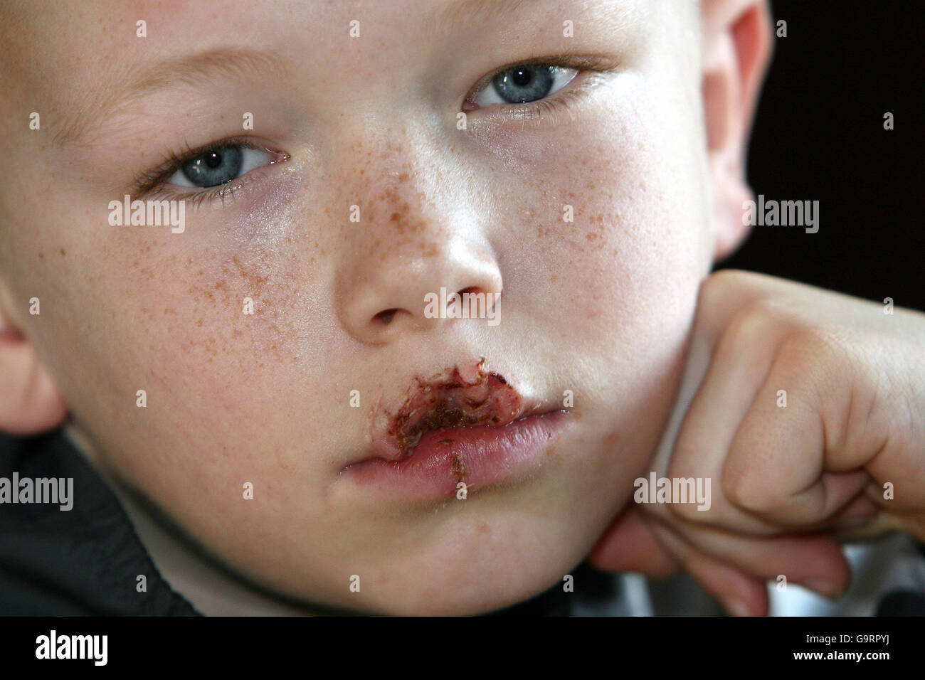 Morsi di cane off ragazzo del labbro Foto Stock
