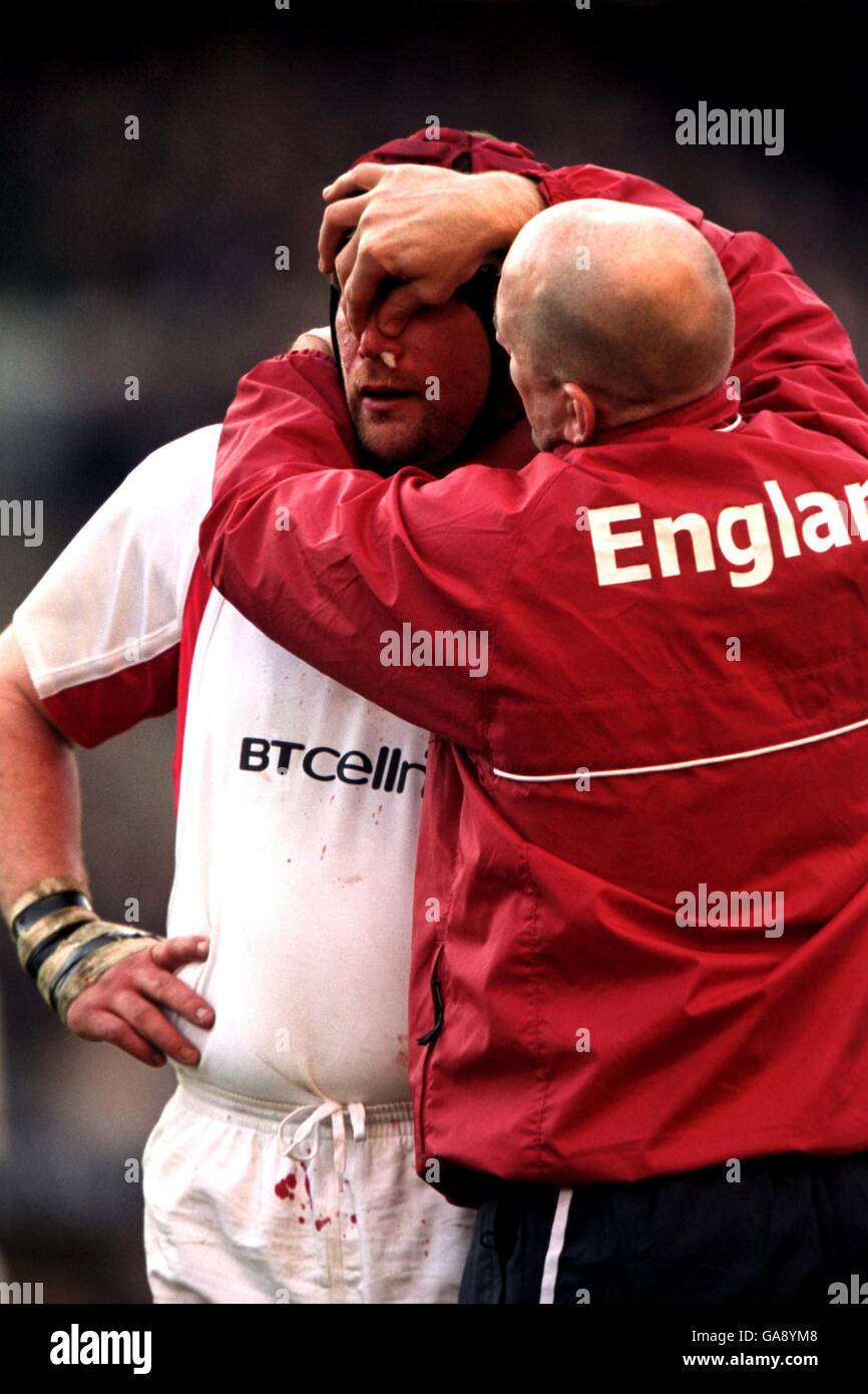 Rugby Union - Lloyds TSB Six Nations Championship - Inghilterra / Irlanda. Il Vickery di Phil dell'Inghilterra è trattato dopo avere il suo naso sanguinato Foto Stock