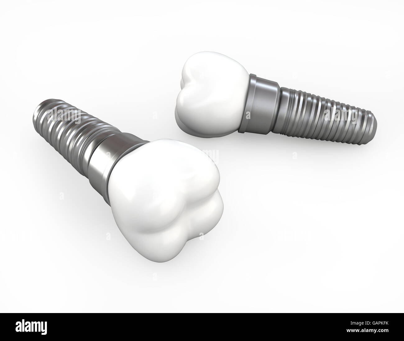 3D illustrazione dei denti impianto su sfondo bianco, concetto dentale. Foto Stock