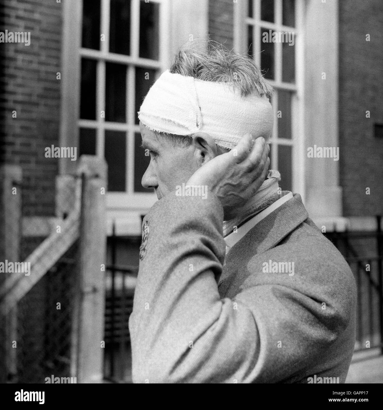 British Crime - sommosse - Notting Hill Gate corsa sommosse - Londra - 1958. Un uomo mostra come è stato ferito durante le rivolte di gara a Notting Hill Gate. Foto Stock