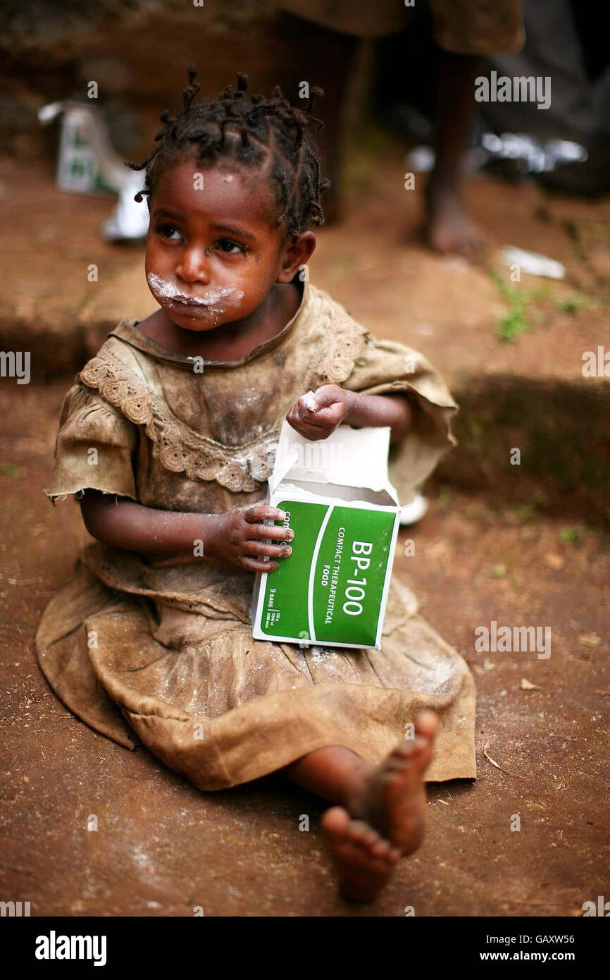 Una ragazza giovane in Giarra Clinic mangiare alcuni BP-100 supplemento alimentare Etiopia meridionale. Decine di migliaia di etiopi sono sull'orlo della fame a causa di una massiccia carenza di cibo. Nelle ultime settimane circa 3,200 bambini e donne sono stati ammessi a programmi di cura alimentare in una sola regione meridionale, poiché gli effetti di una siccità di otto mesi hanno colpito le comunità rurali. Foto Stock