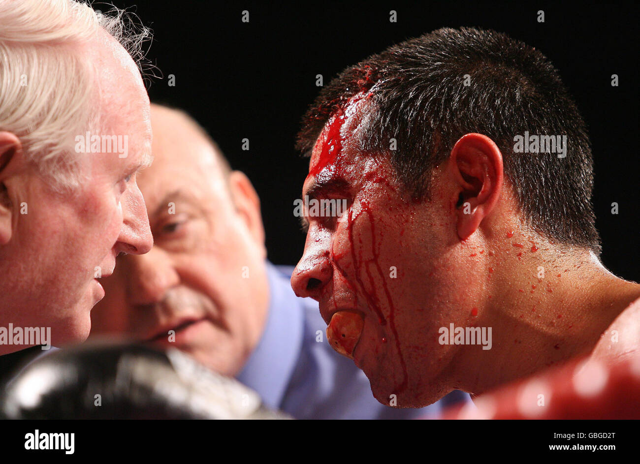 Marco Antonio Barrera con un taglio sul viso durante il cortone leggero agli UOMINI, Manchester. Foto Stock