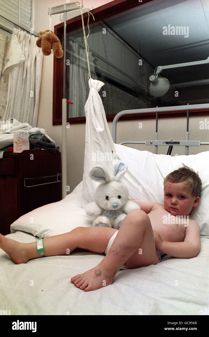 STEPHEN WOOLLEY - ULSTER HOSPITA Foto Stock