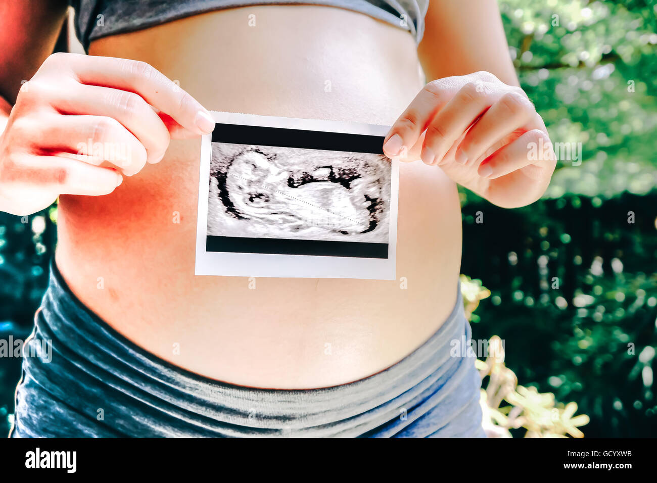 Donna incinta Holding di scansione ad ultrasuoni Foto Foto Stock