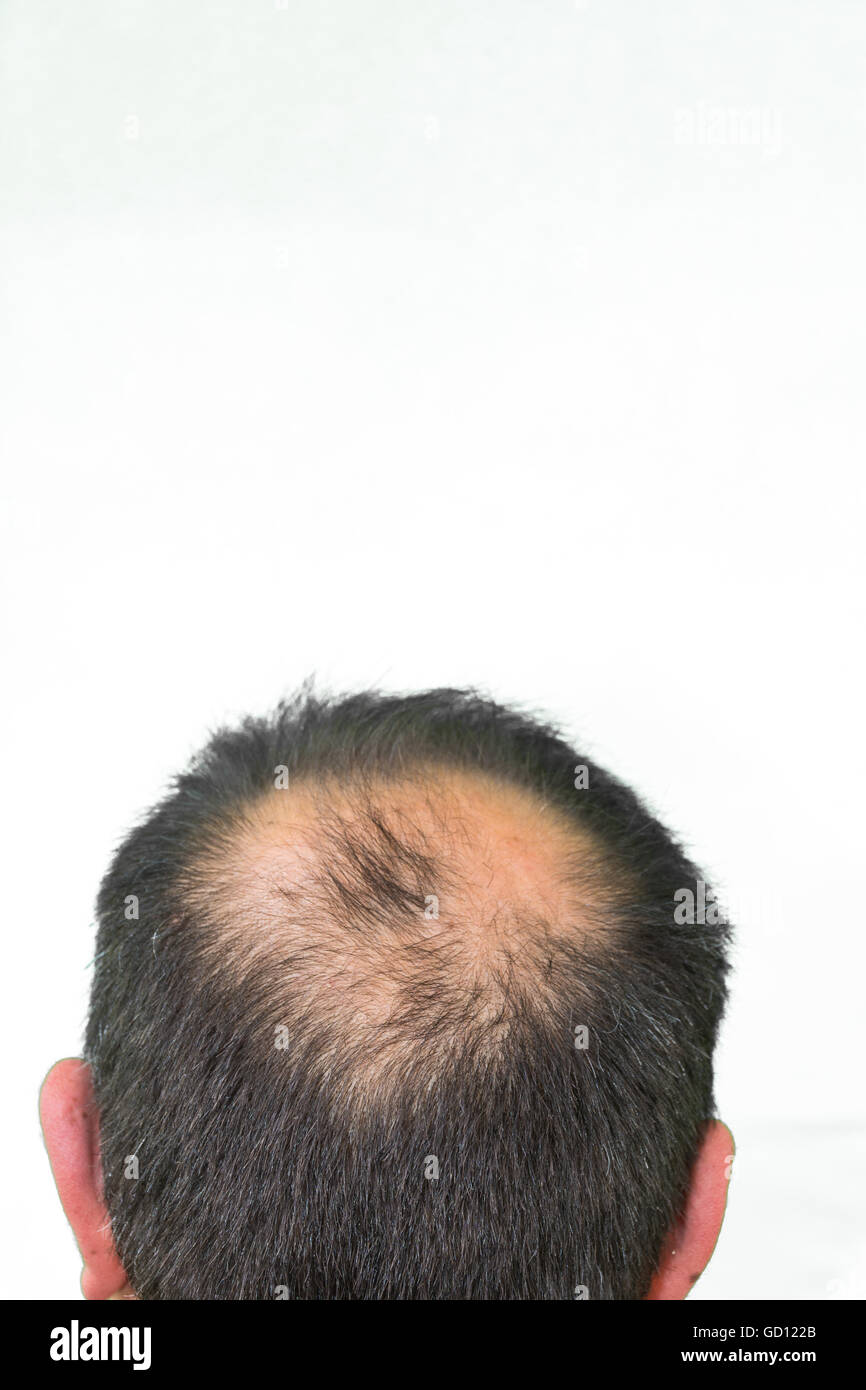 Maturo Uomo Yang Visto Da Dietro Nella Testa Comincia A Perdere I Capelli Comincia Ad Essere Vecchio Foto Stock Alamy