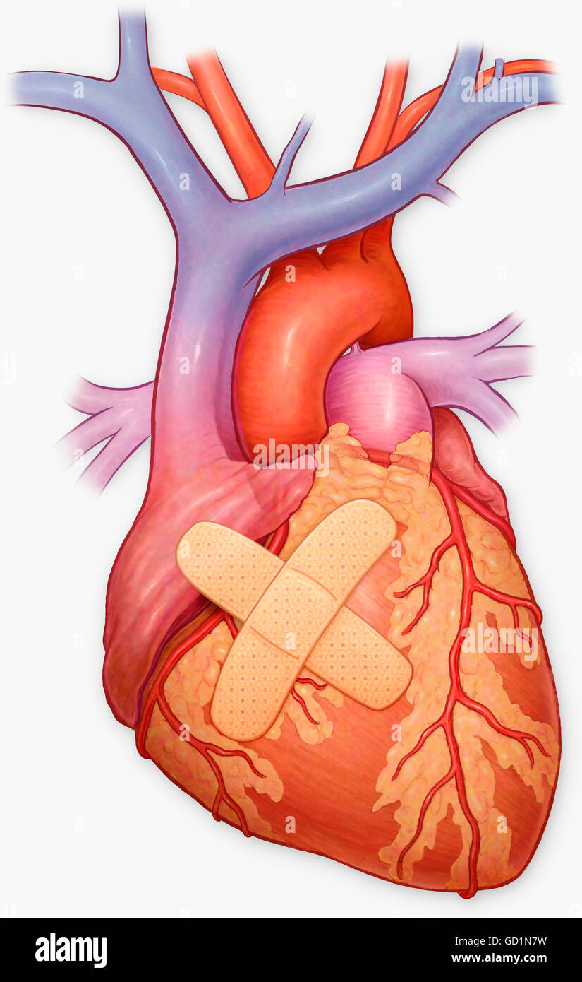 Vista anteriore del cuore e delle arterie coronarie Foto Stock