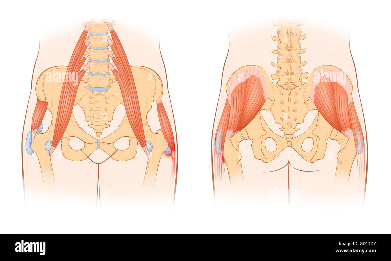 La sindrome dell'anca si verifica quando l'iliopsoas Tendon Subluxes sopra il grande trocantere o l'Eminenza dell'Iliopectinato. Trovato frequentemente con la gente... Foto Stock