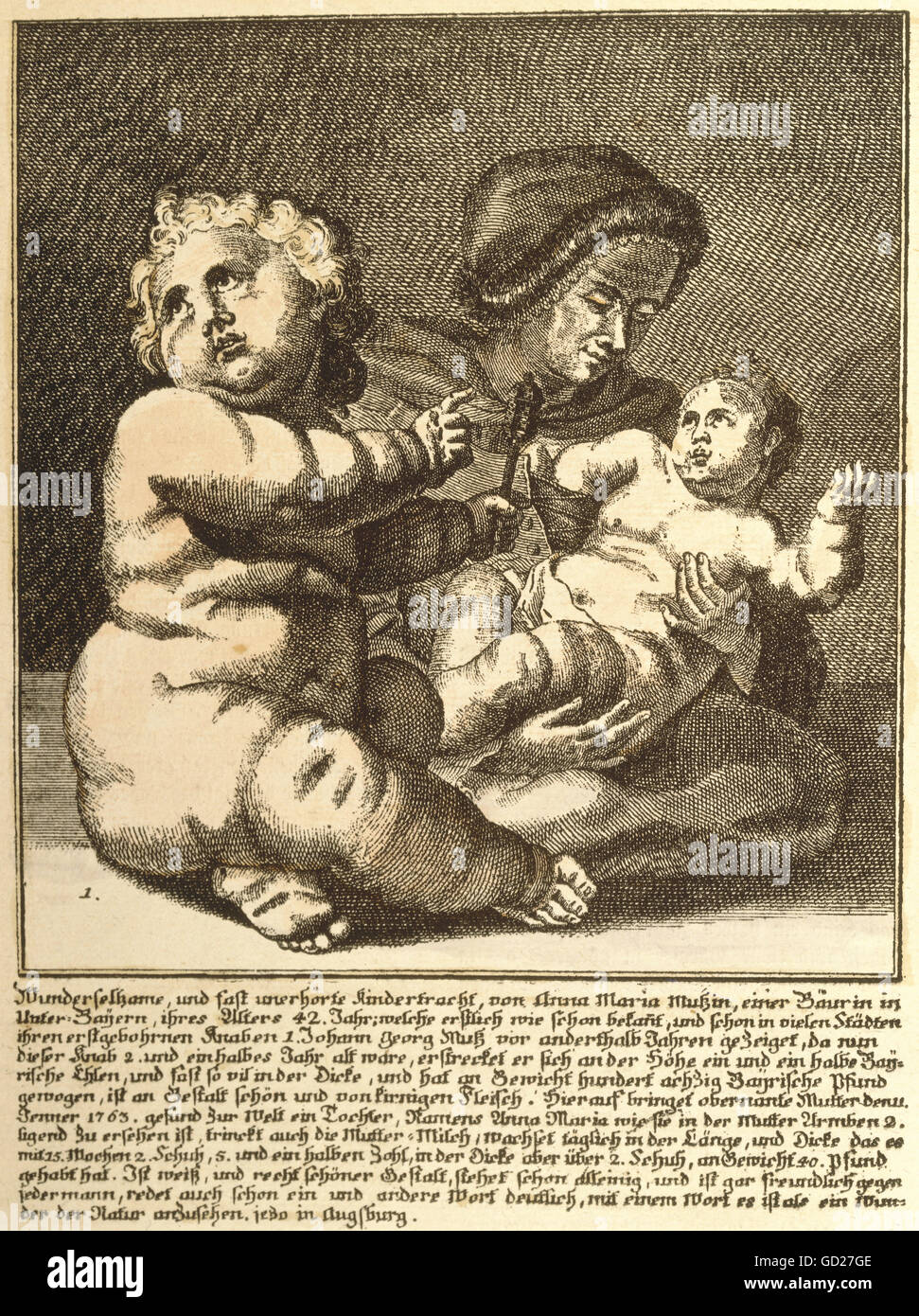 Medicina, anomalie, due giganti di infanti di Lower-Bavarian countrywoman, mostrato nel pubblico di Augusta e altre città, 1763, artista del diritto d'autore non deve essere cancellata Foto Stock