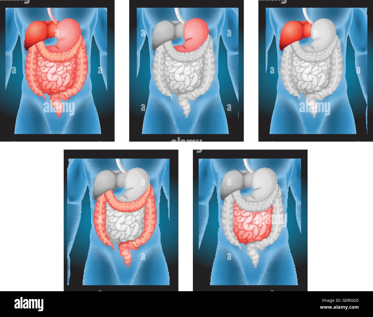 Pellicole a raggi X di organi umani illustrazione Illustrazione Vettoriale