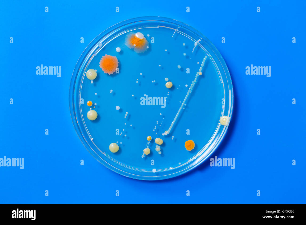 Capsule di Petri con colonie di organismi patogeni Foto Stock