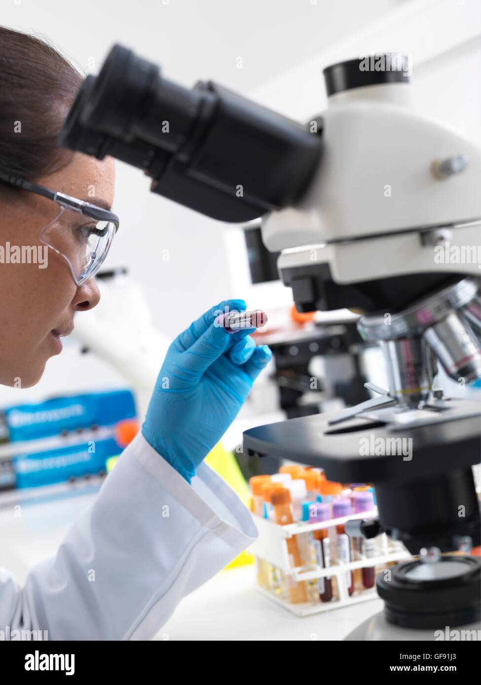 Proprietà rilasciato. Modello rilasciato. Scienziato preparando per visualizzare un campione di sangue sotto un microscopio in laboratorio per i test medici. Foto Stock