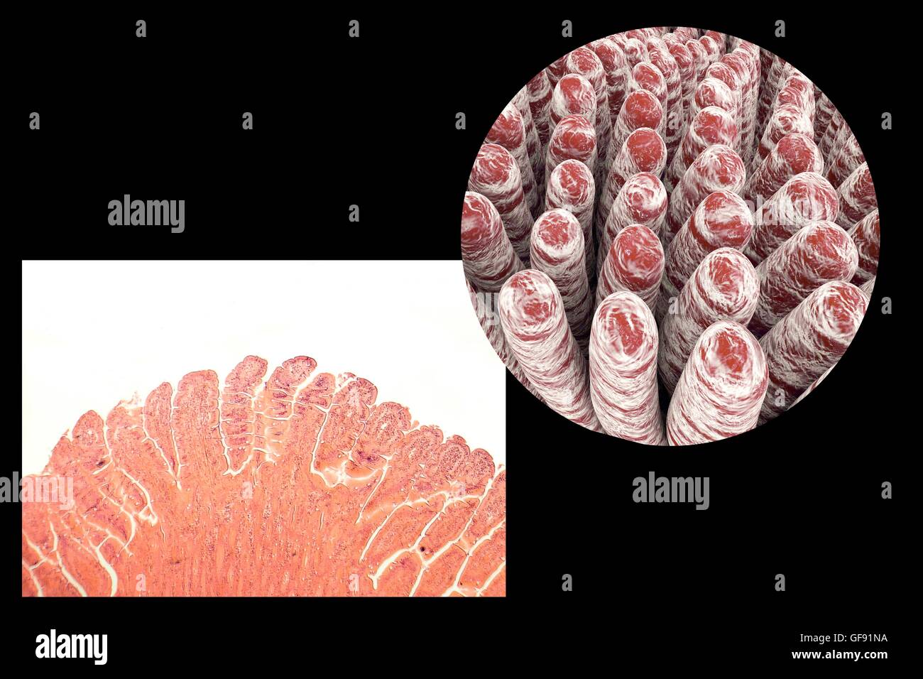 Villi intestinali, micrografia luce e 3D'illustrazione del computer. Villi sono dita che ne aumentano notevolmente la superficie intestinale area per l'assorbimento di nutrienti dal cibo. L'epitelio (strato esterno, piegate) di ciascun coriali contiene en Foto Stock Villi intestinali, micrografia luce e 3D'illustrazione del computer. Villi sono dita che ne aumentano notevolmente la superficie intestinale area per l'assorbimento di nutrienti dal cibo. L'epitelio (strato esterno, piegate) di ciascun coriali contiene en Foto Stock