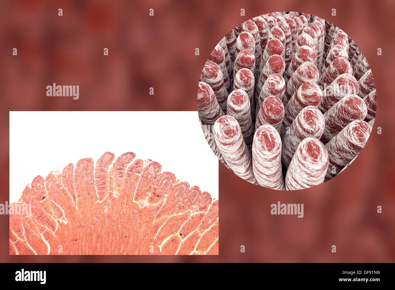 Villi intestinali, micrografia luce e 3D'illustrazione del computer. Villi sono dita che ne aumentano notevolmente la superficie intestinale area per l'assorbimento di nutrienti dal cibo. L'epitelio (strato esterno, piegate) di ciascun coriali contiene en Foto Stock Villi intestinali, micrografia luce e 3D'illustrazione del computer. Villi sono dita che ne aumentano notevolmente la superficie intestinale area per l'assorbimento di nutrienti dal cibo. L'epitelio (strato esterno, piegate) di ciascun coriali contiene en Foto Stock