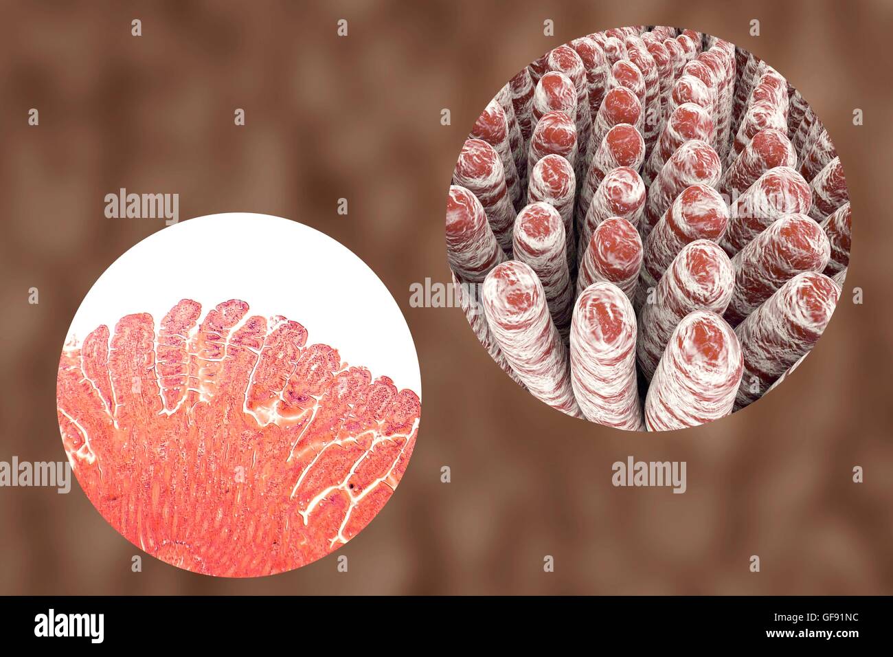 Villi intestinali, micrografia luce e 3D'illustrazione del computer. Villi sono dita che ne aumentano notevolmente la superficie intestinale area per l'assorbimento di nutrienti dal cibo. L'epitelio (strato esterno, piegate) di ciascun coriali contiene en Foto Stock Villi intestinali, micrografia luce e 3D'illustrazione del computer. Villi sono dita che ne aumentano notevolmente la superficie intestinale area per l'assorbimento di nutrienti dal cibo. L'epitelio (strato esterno, piegate) di ciascun coriali contiene en Foto Stock