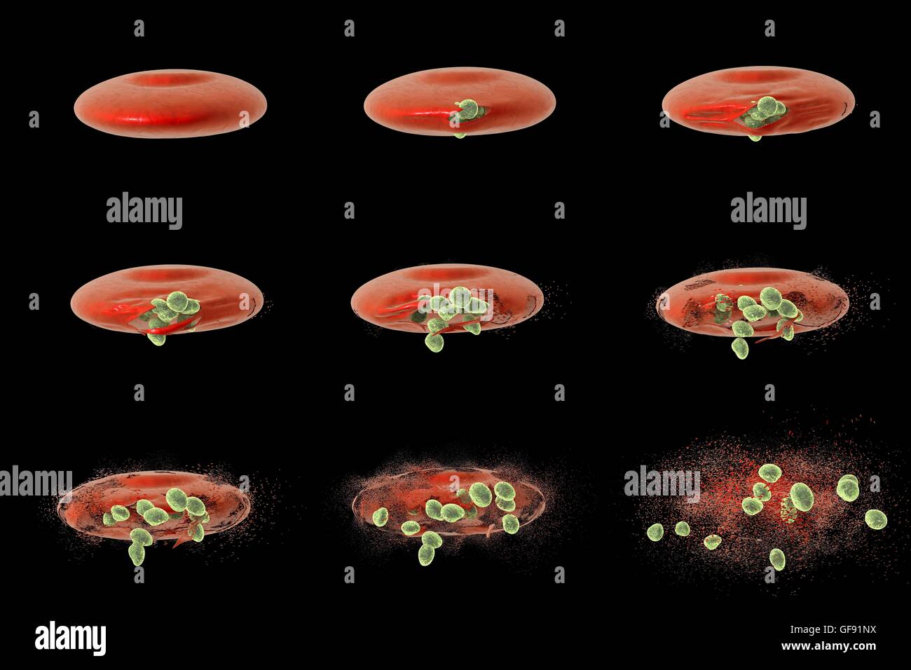 Computer illustrazione che mostra diverse fasi di rilascio della malaria merozoiti da un globulo rosso. La malaria è causata da Plasmodium sp. protozoi parassiti trasmessi dalla zanzara anofele femmina sp. zanzare. Quando i morsi di zanzara una persona, sporozoites in Foto Stock
