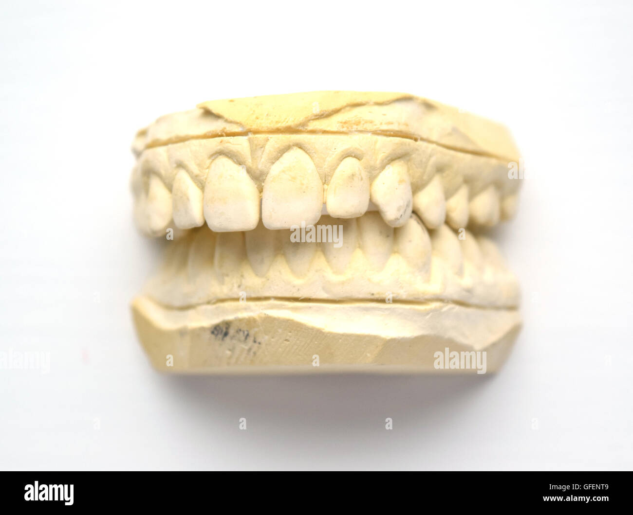 Impressione di gesso di denti con un piccolo spazio in denti anteriori (diastema) - isolato Foto Stock