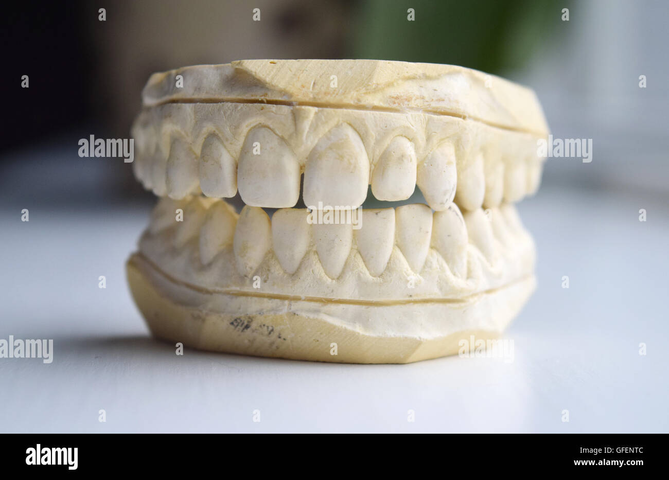 Impressione di gesso di denti con un piccolo spazio in denti anteriori (diastema) - isolato Foto Stock