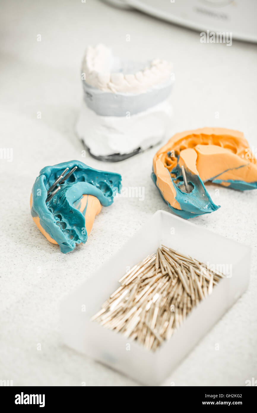 Impronta dentale e modello di denti, di dentiera concept Foto Stock