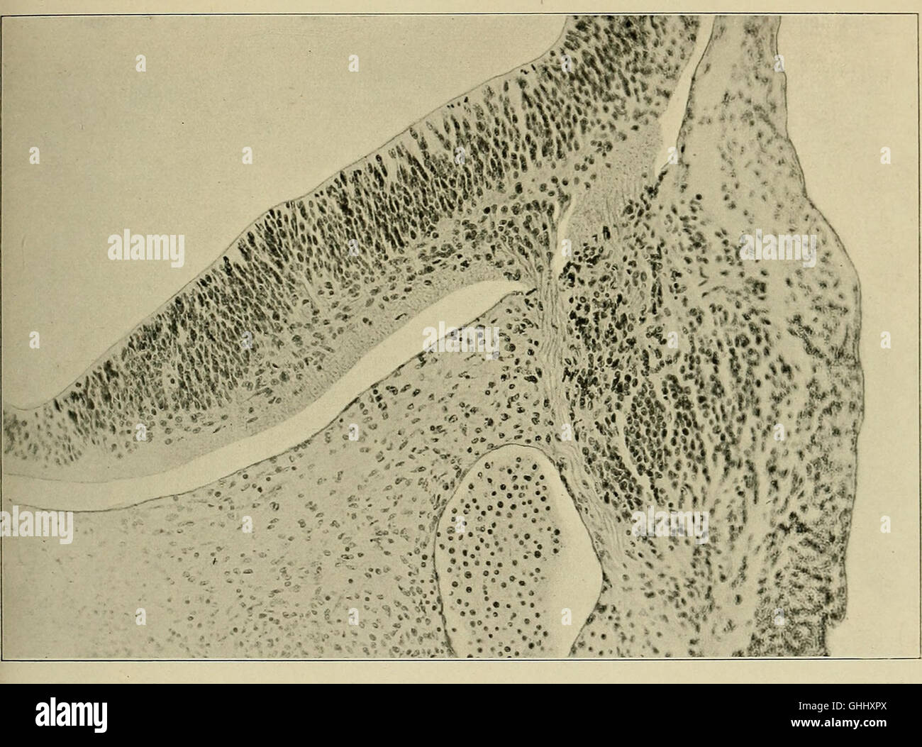 Questo studio tedesco del 1904 indaga lo sviluppo del cervello umano durante i primi mesi di vita, fornendo informazioni scientifiche sullo sviluppo precoce del cervello e sulle funzioni cognitive nei neonati. Foto Stock
