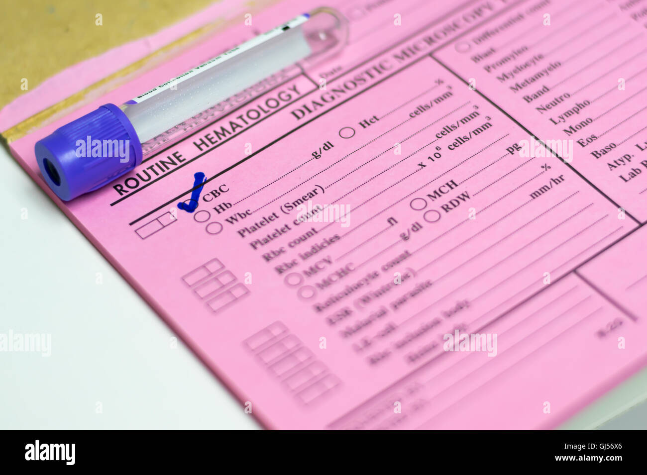 Tubo di prova sul modulo di richiesta in laboratorio Foto Stock