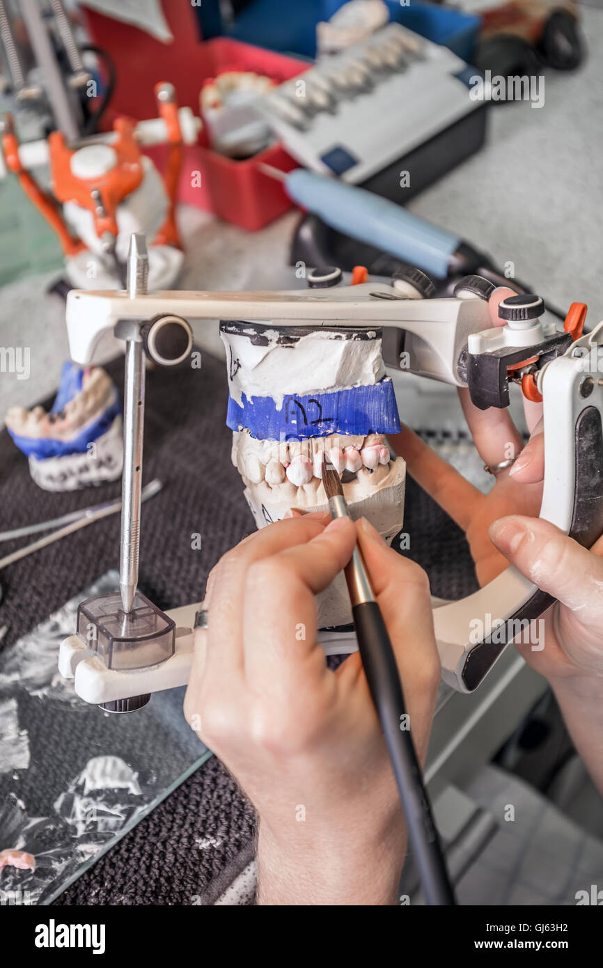 Odontotecnico dipingere un falso denti Foto Stock