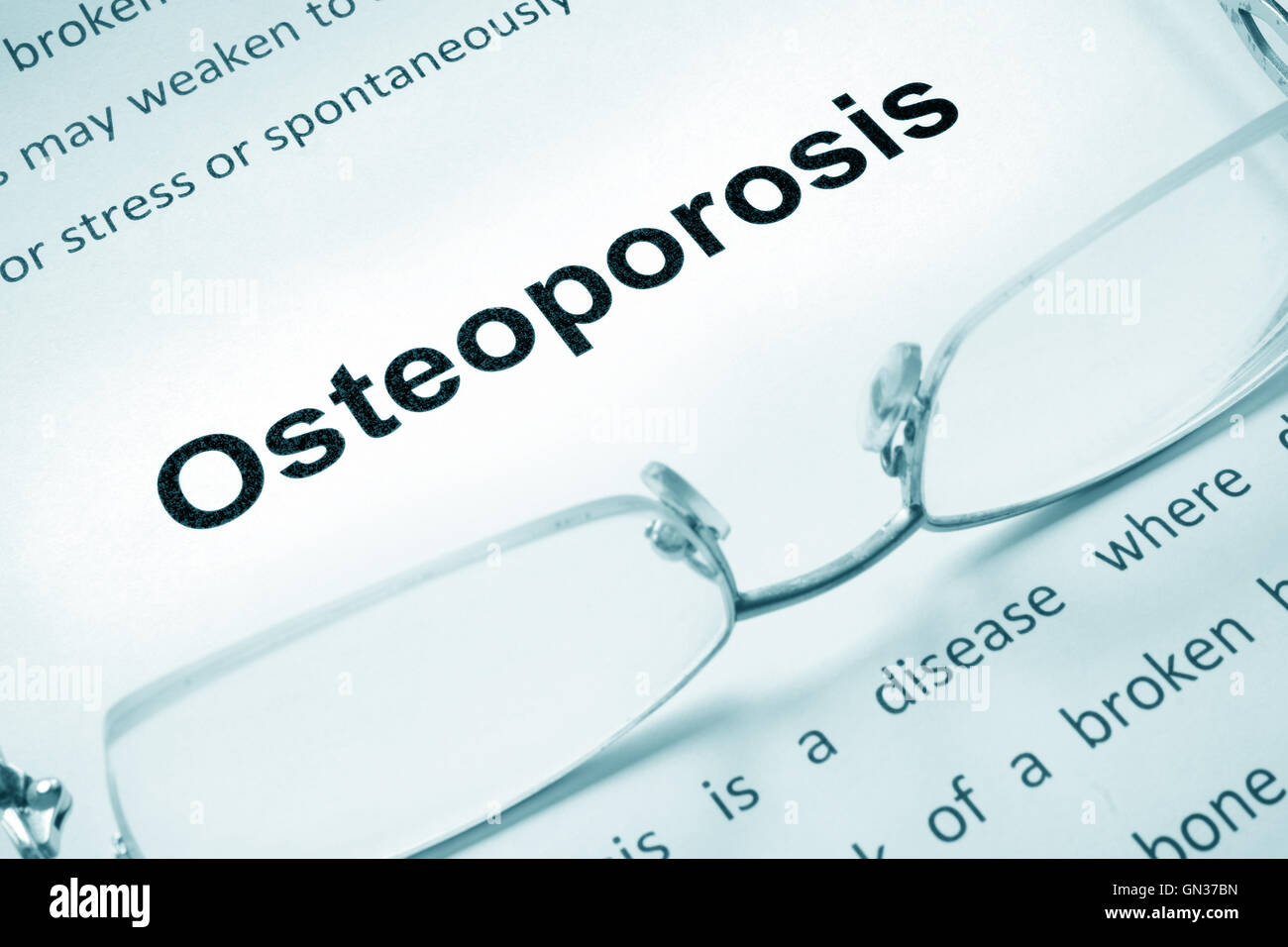 L'Osteoporosi segno su un foglio di carta e bicchieri. Foto Stock