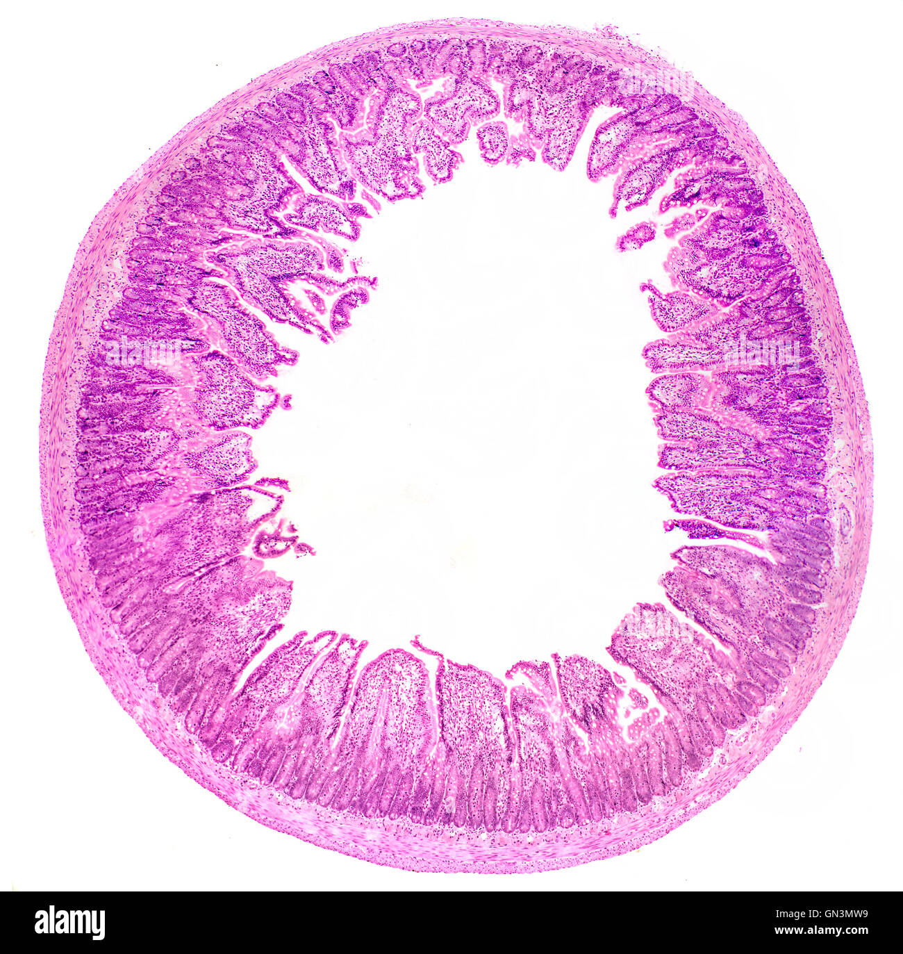 Il piccolo intestino TS in campo chiaro fotomicrografia mucosa mostra villi intestinali e cripte di Lieberkühn. Foto Stock Il piccolo intestino TS in campo chiaro fotomicrografia mucosa mostra villi intestinali e cripte di Lieberkühn. Foto Stock