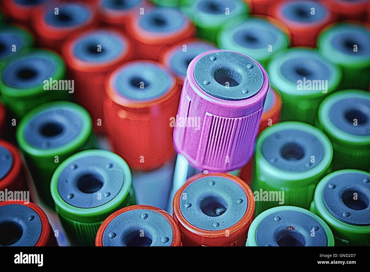 Close up medical provetta con i campioni di sangue Foto Stock