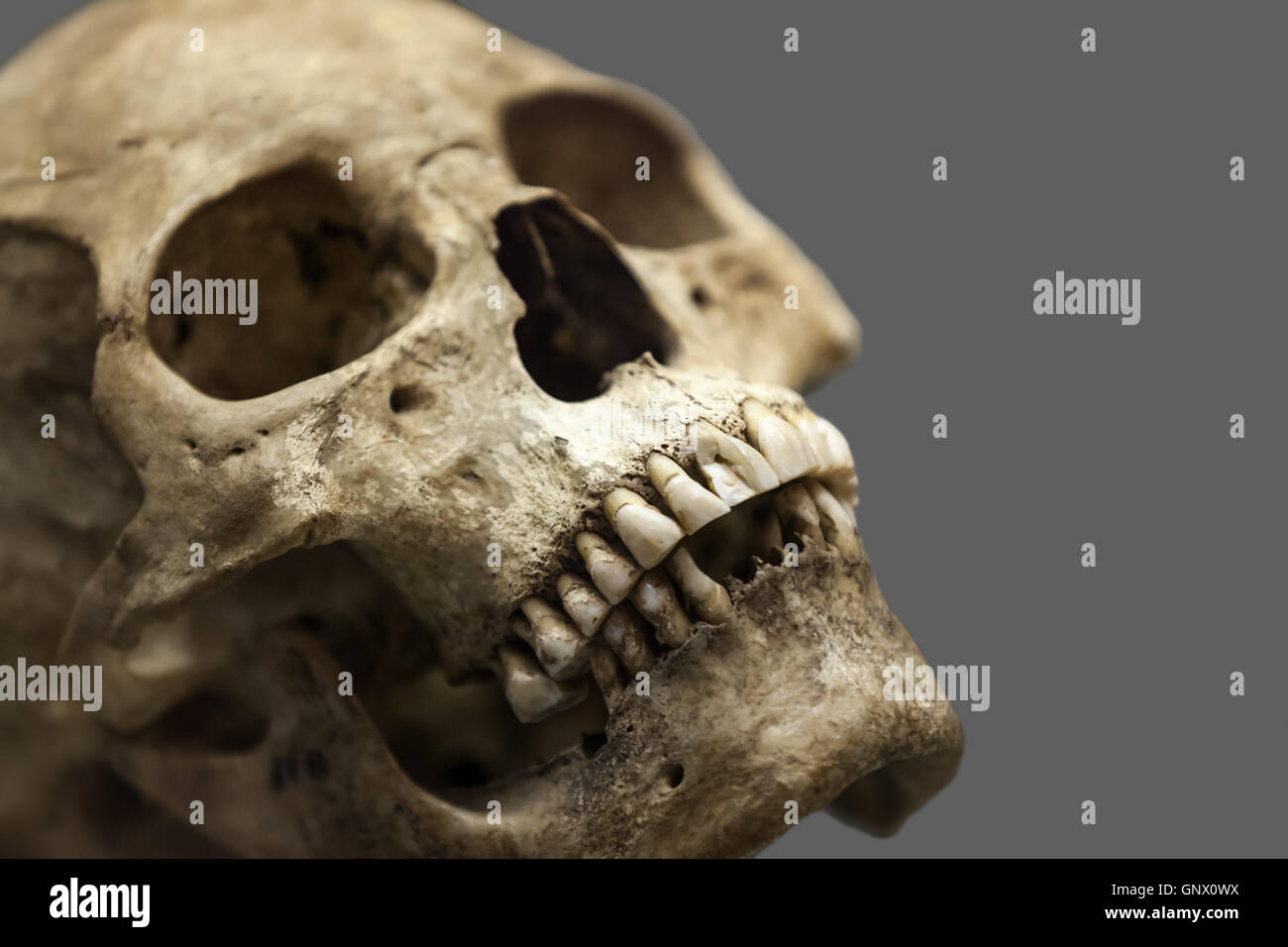 Cranio umano osso Foto Stock