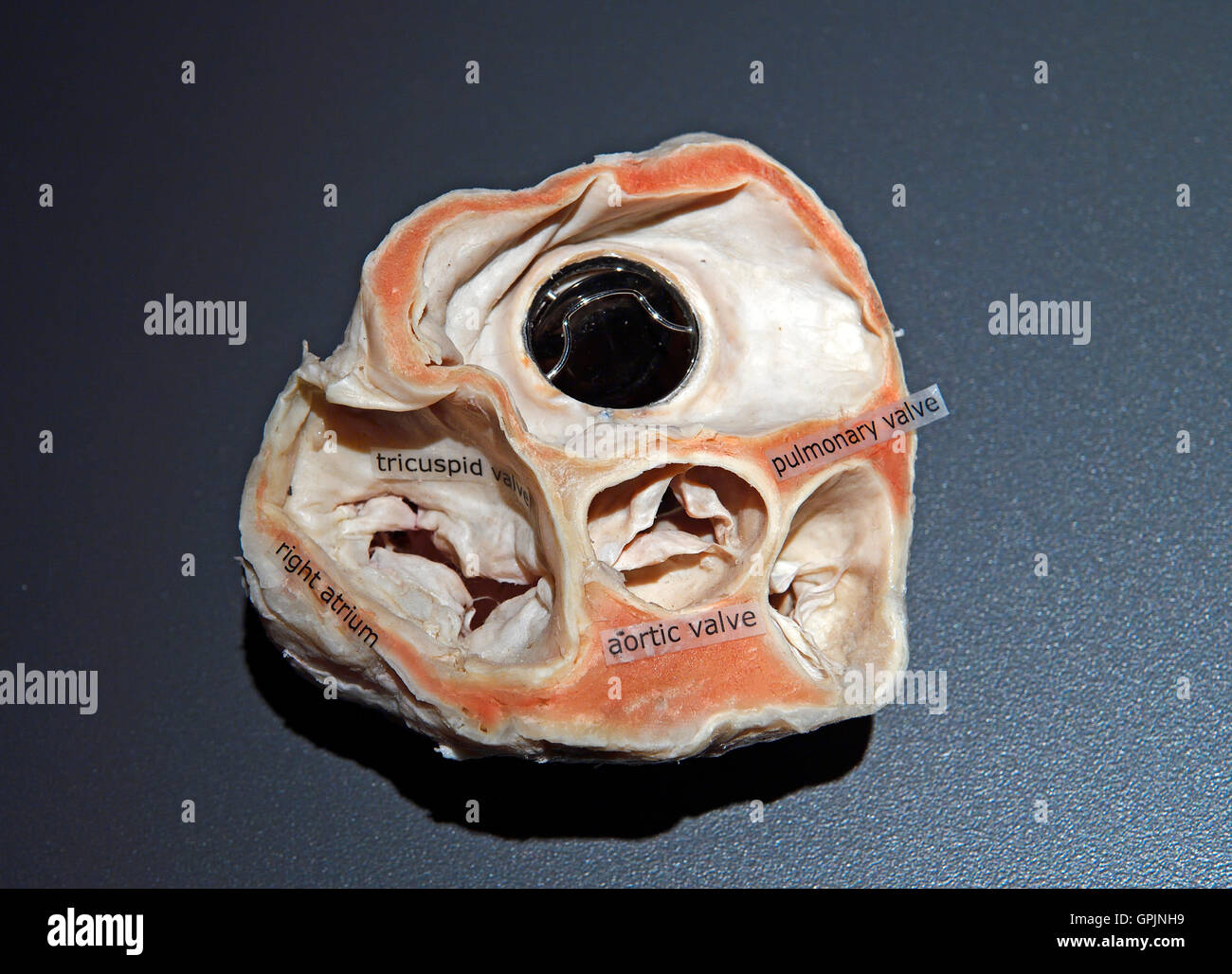 Plastinate, cuore umano con valvola cardiaca artificiale, corpo mondi, Menschen Museum di Berlino, Germania Foto Stock