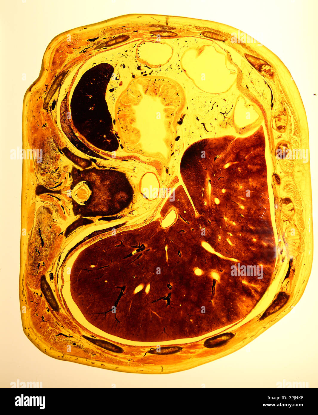 Plastinate, sezione trasversale attraverso l'addome umano, corpo mondi, Menschen Museum di Berlino, Germania Foto Stock