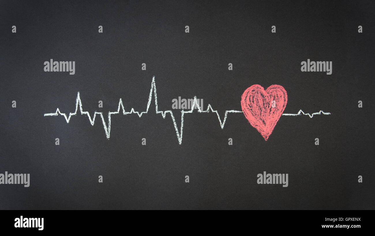 Schema di heartbeat Foto Stock