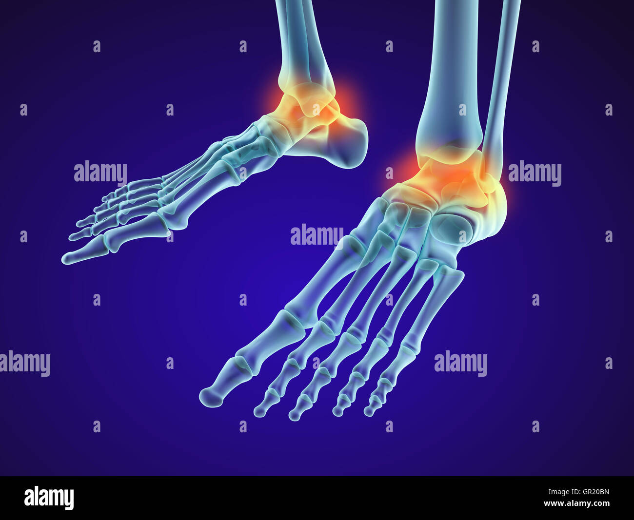 Piede dello scheletro - injuryd osso astragalico. Vista a raggi x. Accurata dal punto di vista medico 3D illustrazione Foto Stock