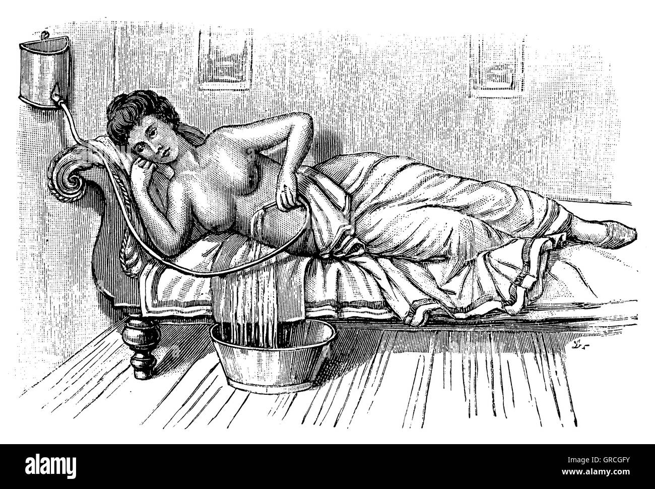 Irrigazione dello stomaco in una posizione sdraiata Foto Stock