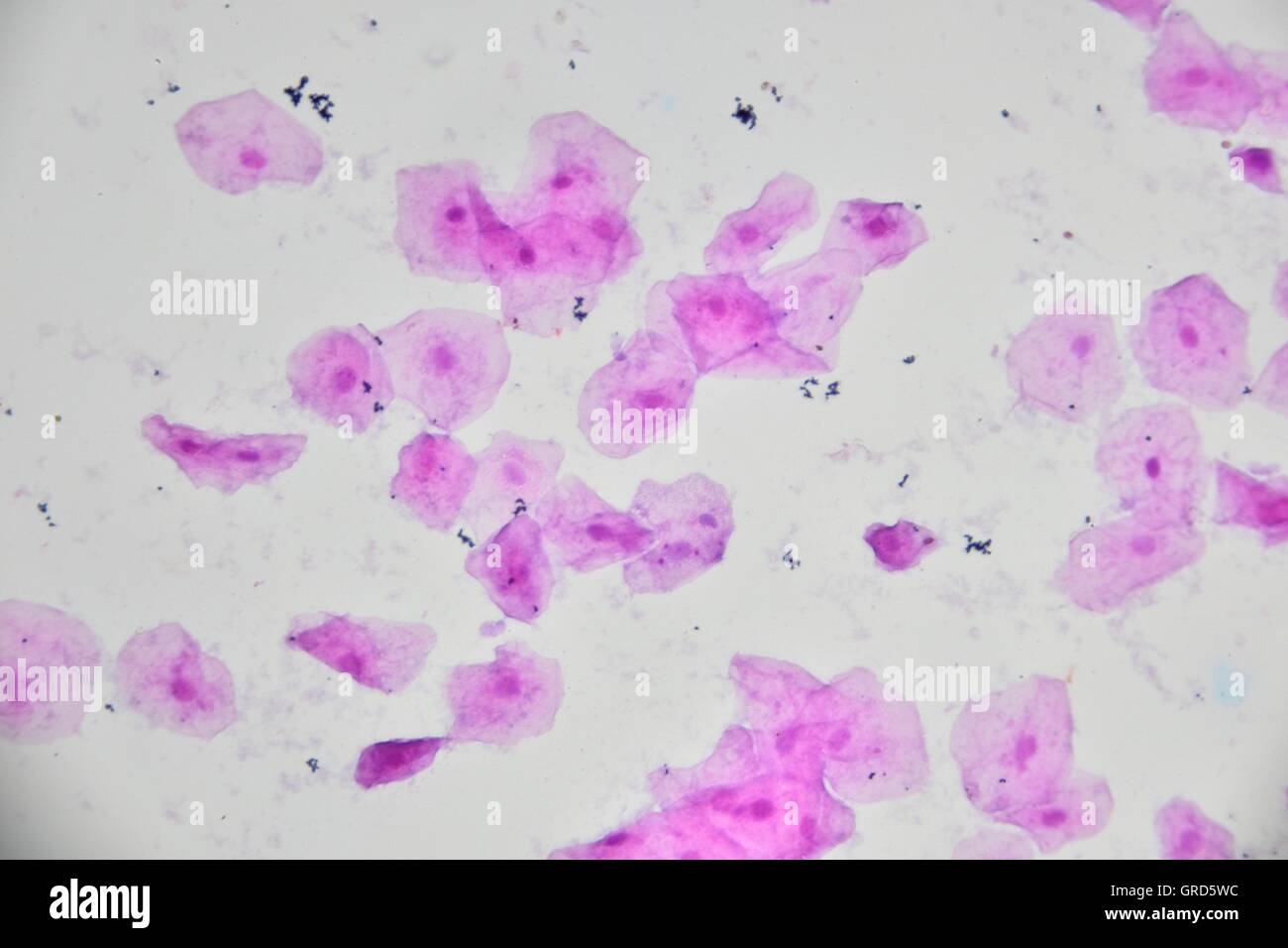 Immagine microscopica di cellule umane di mucosa orale con batteri. Ingrandimento di 400x. Foto Stock