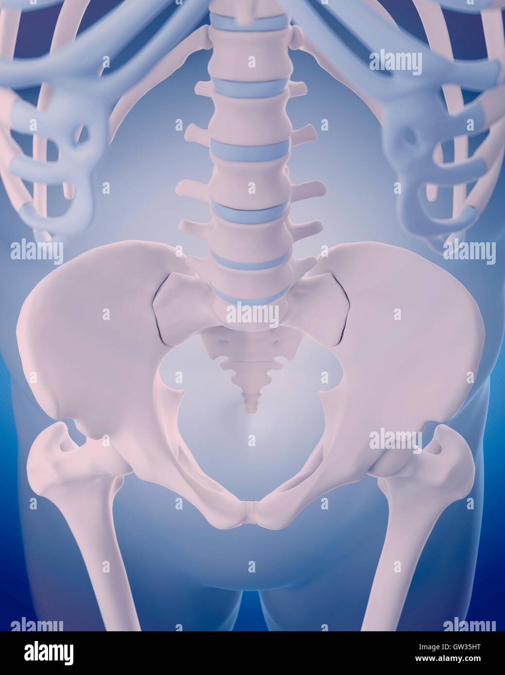 Modello Colonna Vertebrale Lombare Umana Con Ernia Del Disco – 1:1,5 – Per Studio E Insegnamento - 3