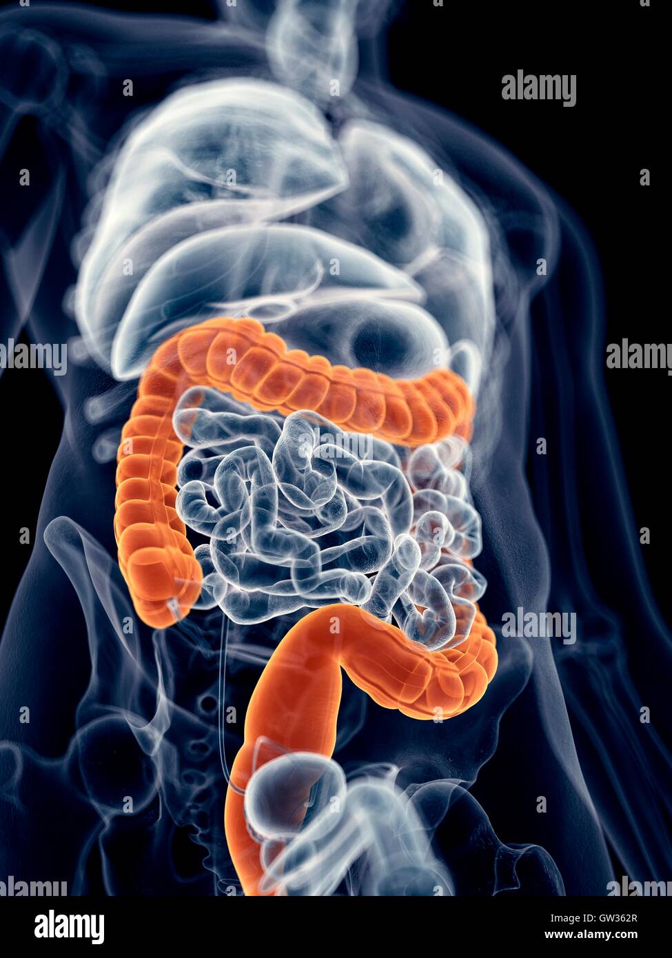 Colon umano, illustrazione. Foto Stock