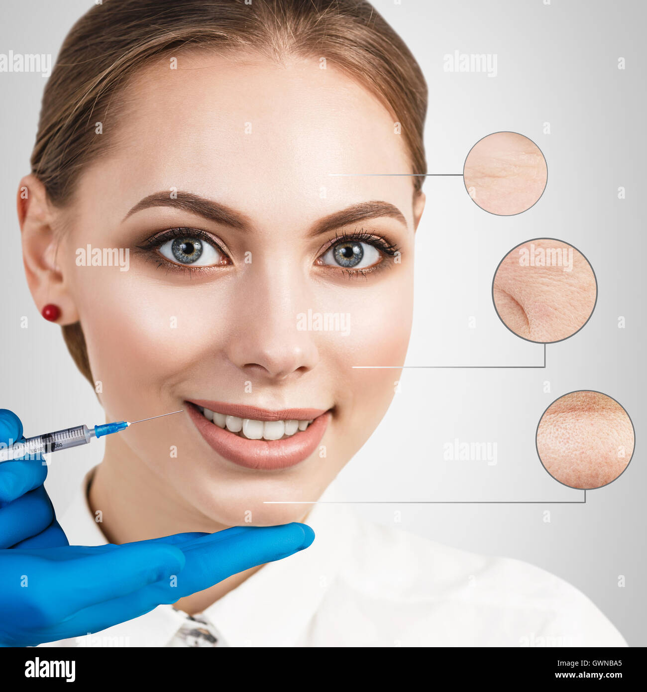 Iniezione di cosmetici per il bel volto femminile. Foto Stock