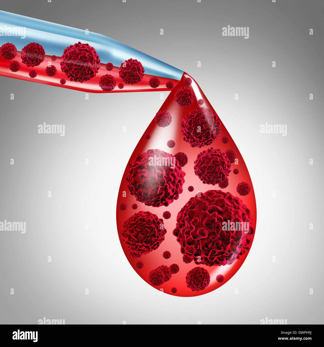 I tumori del sangue la diagnosi medica nozione come un contagocce con sangue infetto da cellula maligna come un simbolo concettuale per la leucemia sintomi o malattie del sangue come un 3D'illustrazione. Foto Stock