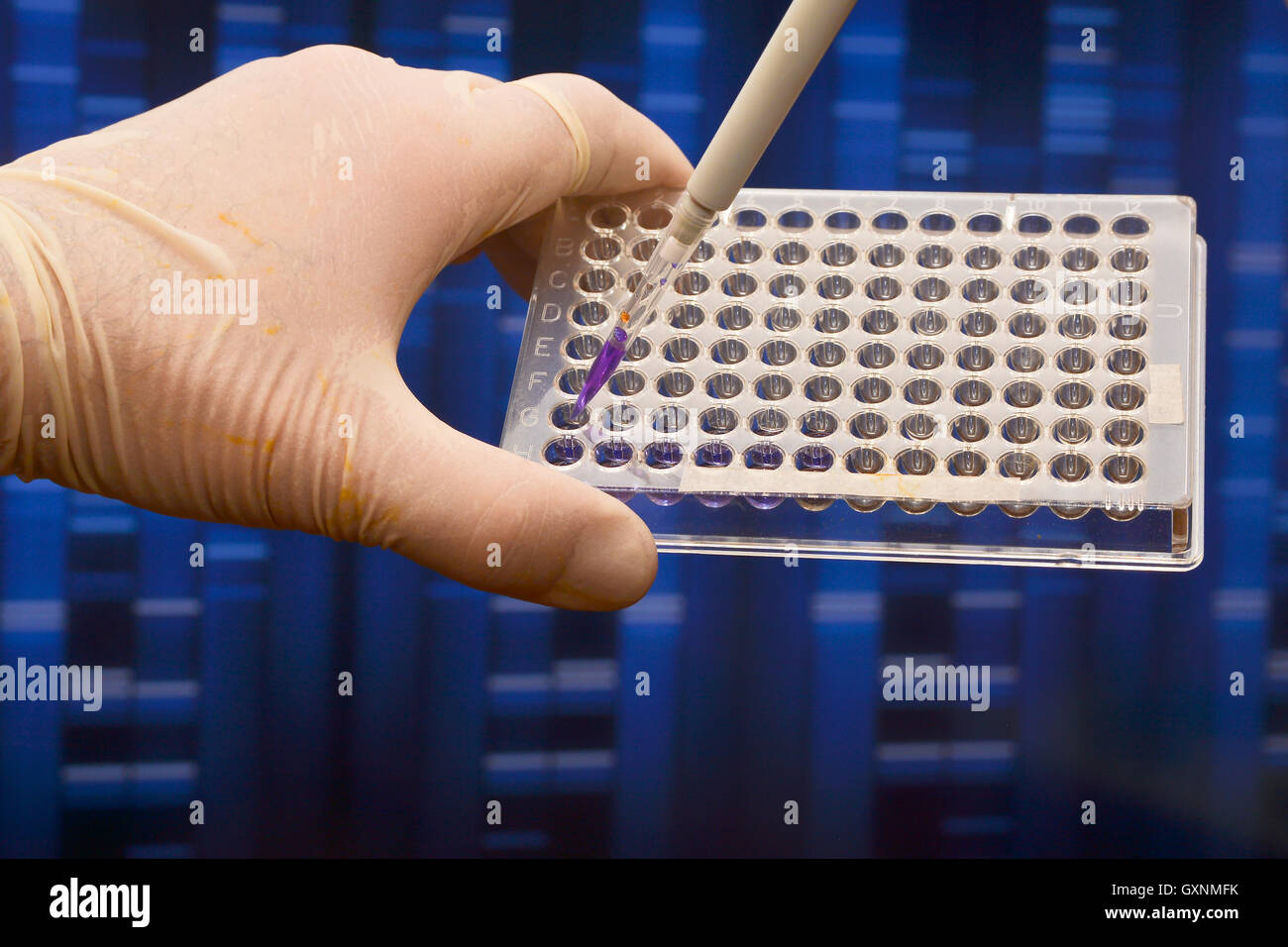 Prove della scienza medica in laboratorio. Il test del DNA per la diagnosi di malattie umane. Foto Stock