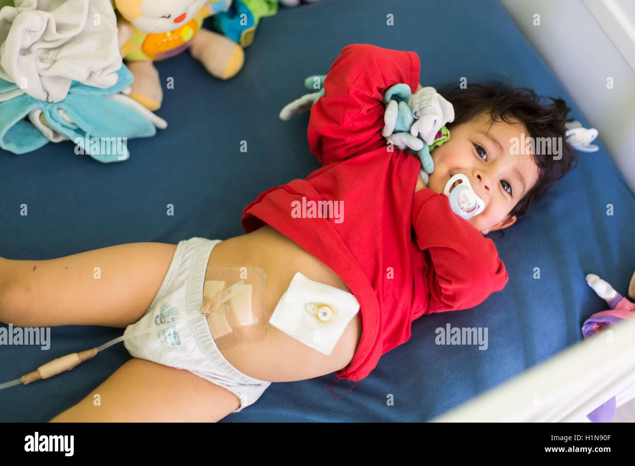 2 anno-vecchio ragazzo soffre di insufficienza renale, subendo un automatizzato di dialisi peritoneale a casa. Foto Stock