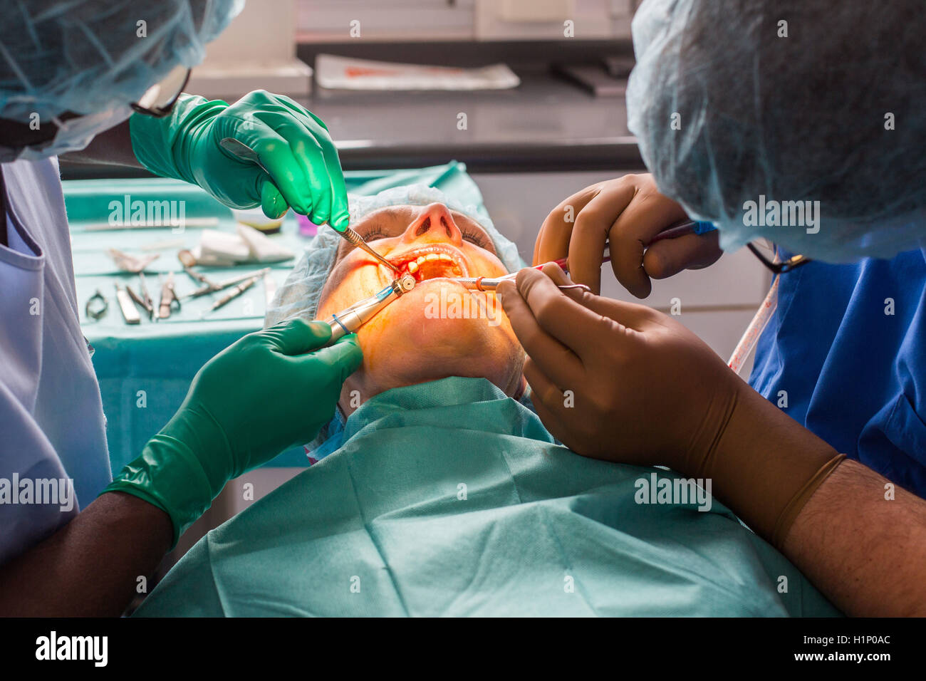 Chirurgia di impianto dentale. Foto Stock