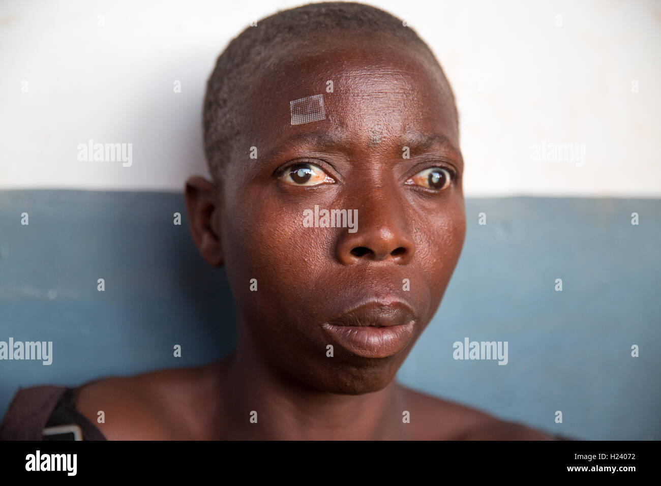 Ospedale Ribaue, Ribaue, Nampula Provincia, Mozambico, Agosto 2015: . Laurinda Diego da Lalaua ha la cataratta bilaterale. Ella è stata diagnosticata con cataratta bilaterale da Nampula e Ribaue outreach team. Lei avrà il suo cataratcs rimosso in corrispondenza Ribaue Hopsital. Questo progetto è supportato da Sightsavers. Foto di Mike Goldwater Foto Stock