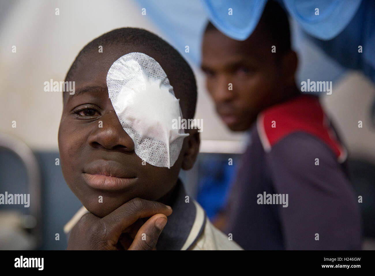 Ospedale Ribaue, Ribaue, Nampula Provincia, Mozambico, Agosto 2015: Saide Antonio, 16, avrà il bendaggio rimosso dal suo occhio sinistro domani dopo la sua seconda operazione per cataratta bilaterale. Foto di Mike Goldwater Foto Stock