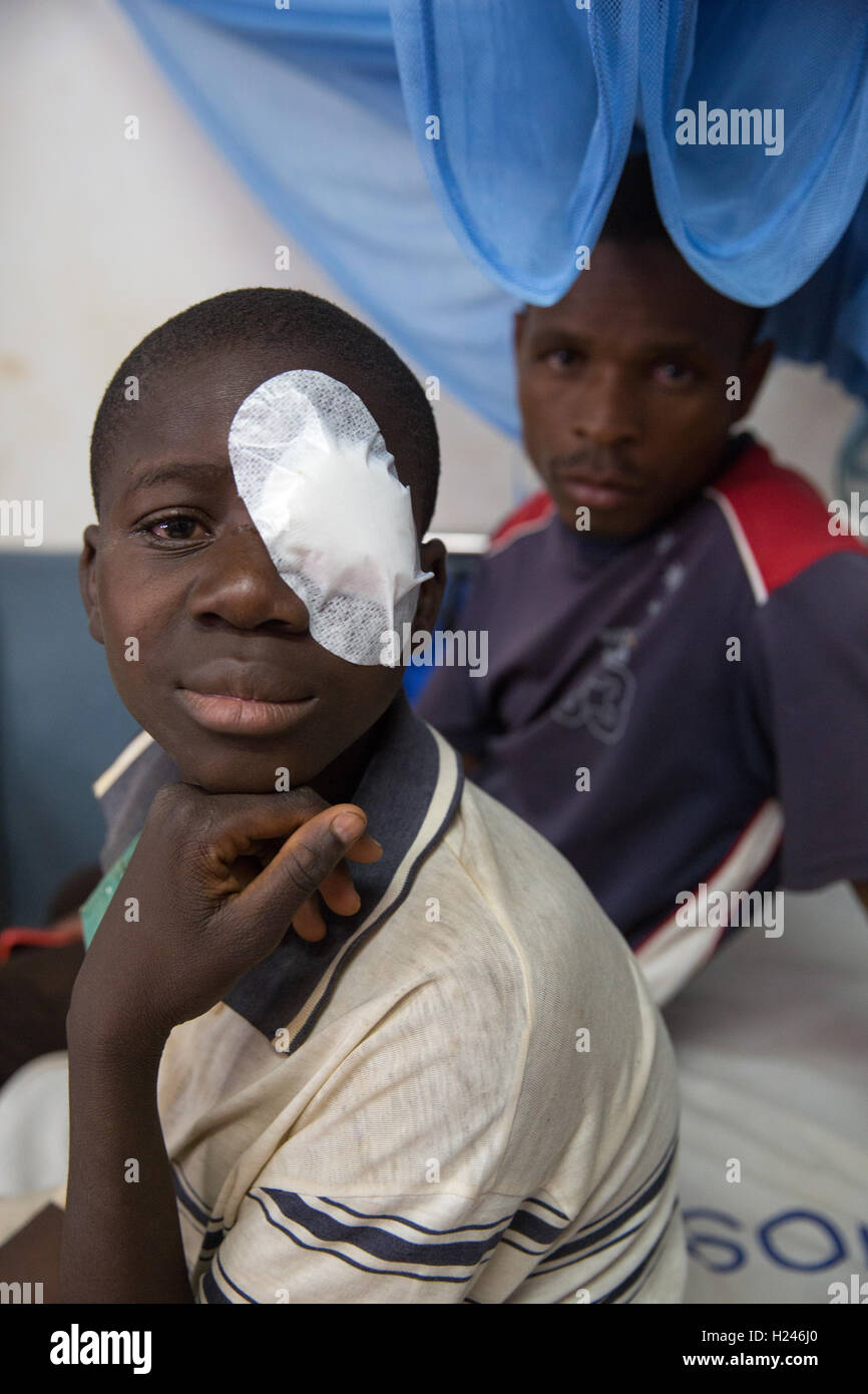 Ospedale Ribaue, Ribaue, Nampula Provincia, Mozambico, Agosto 2015: Saide Antonio, 16, avrà il bendaggio rimosso dal suo occhio sinistro domani dopo la sua seconda operazione per cataratta bilaterale. Foto di Mike Goldwater Foto Stock
